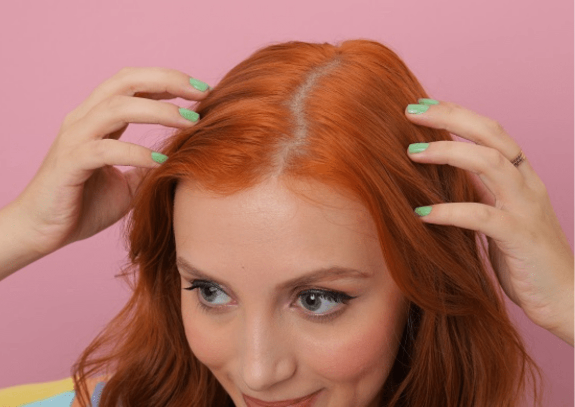 Cabelo Oleoso
