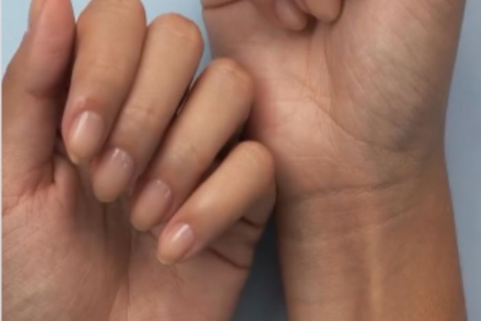 resultado aplicação caneta para cutículas